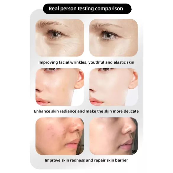 Photon Rejuvenation Näohooldus LED-mask